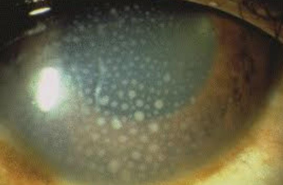 Child Eye Care Pune